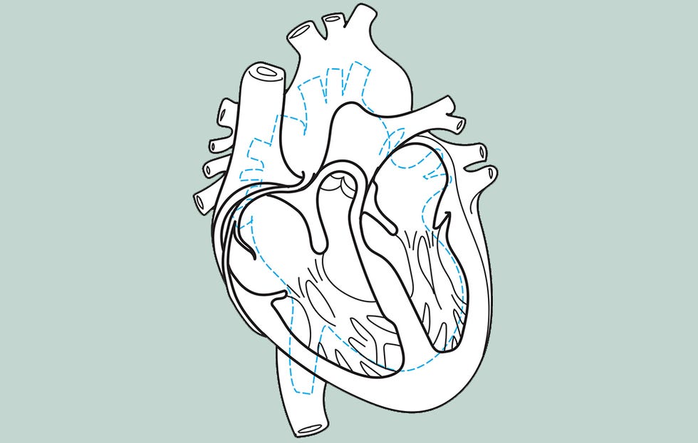 A Change of Heart overall size