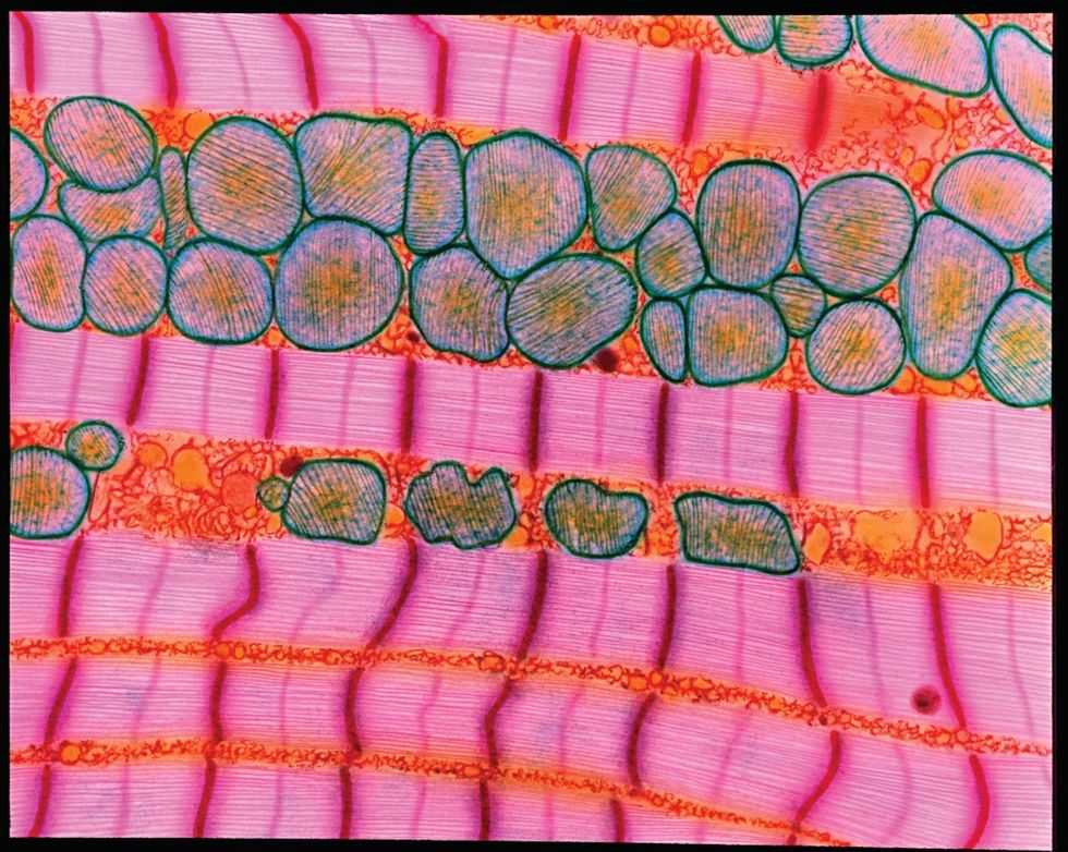 in deze uitvergrote dwarsdoorsnede van compact bot vertakken osteocyten zich om verbindingen met andere cellen aan te leggen