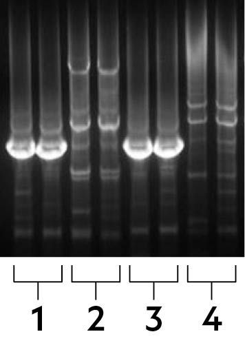 Elektroforese resultaten tonen de pijnongevoeligheids mutatie in het DNA van Cameron 1 en dat van haar zoon 3 maar niet in die van haar moeder 2 en dochter 4