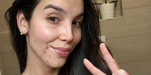 paola di benedetto con l'acne su instagram «sto bene anche così»