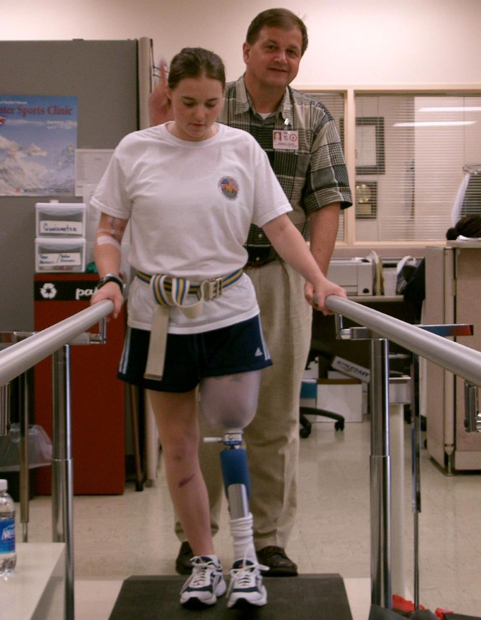 Learning to walk with prosthetic leg