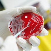 Pathologist analyzing bacterial cultures in petri dsh pathologist analyzing bacterial cultures in petri dsh