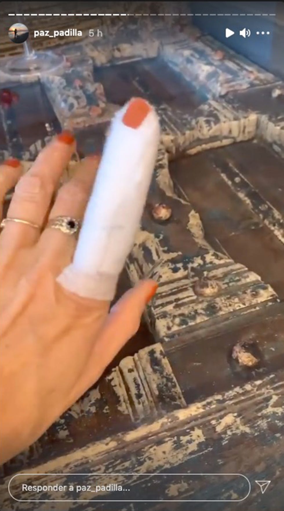 paz padilla tiene un accidente doméstico en un dedo al cortarse con un cuchillo