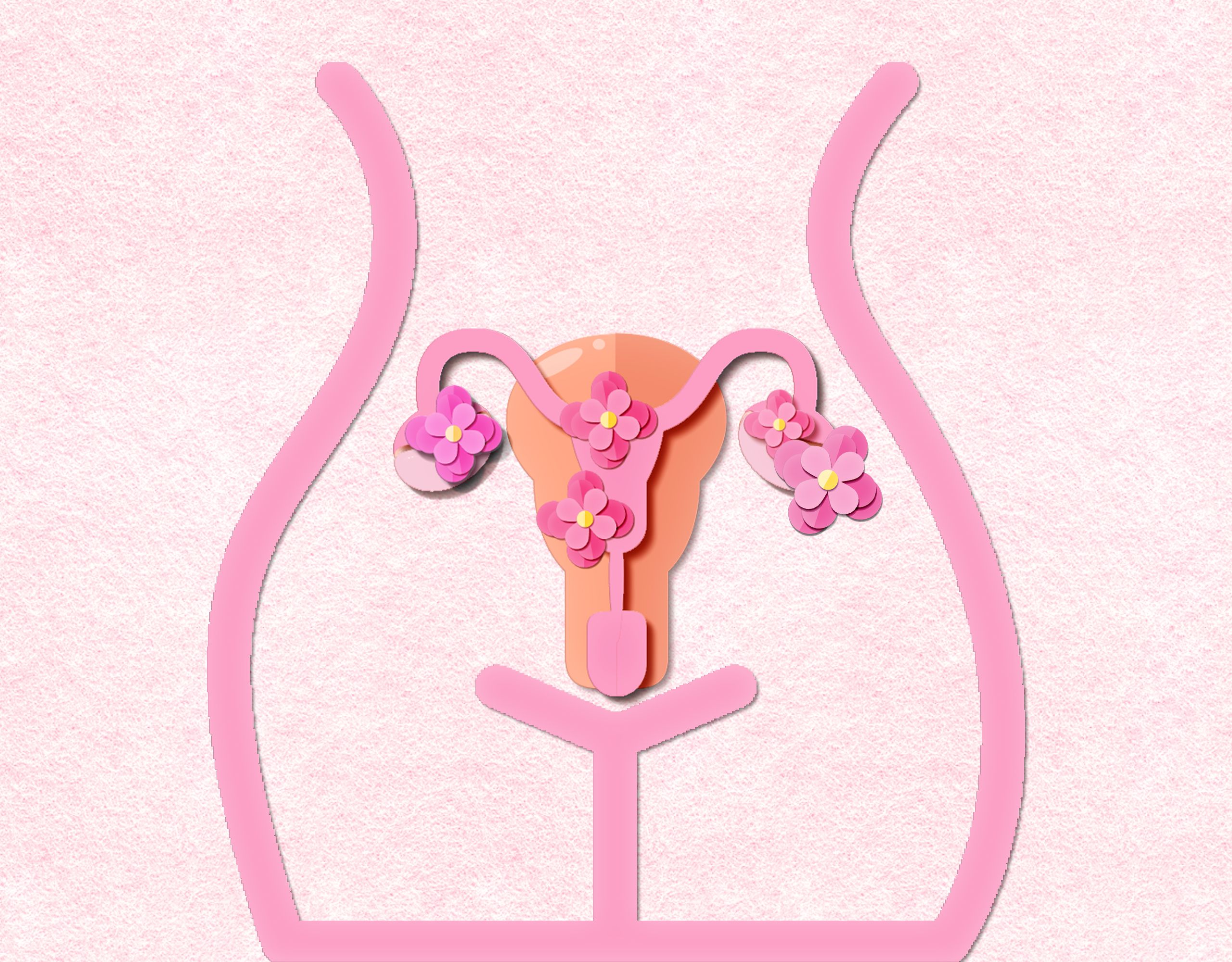 pcos syndrome, polycystic ovary syndrome concept in paper cut