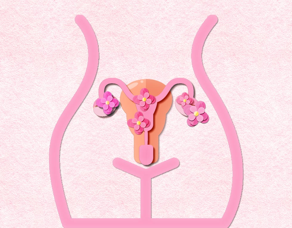 pcos syndrome, polycystic ovary syndrome concept in paper cut