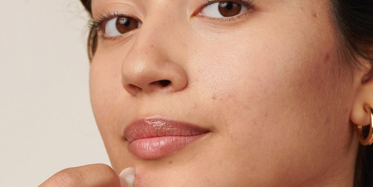 The Best Hormonal Acne Treatments, According to Experts