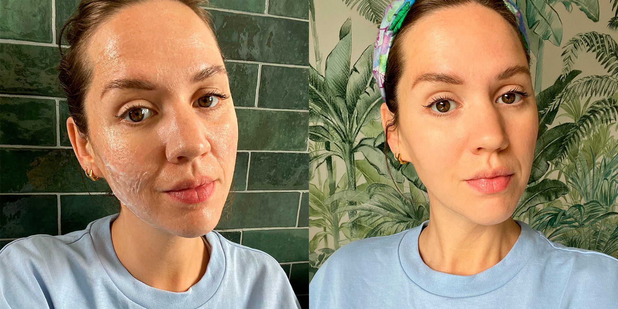 This Woman's Before-and-After Retinol Results Are Going Viral on Reddit