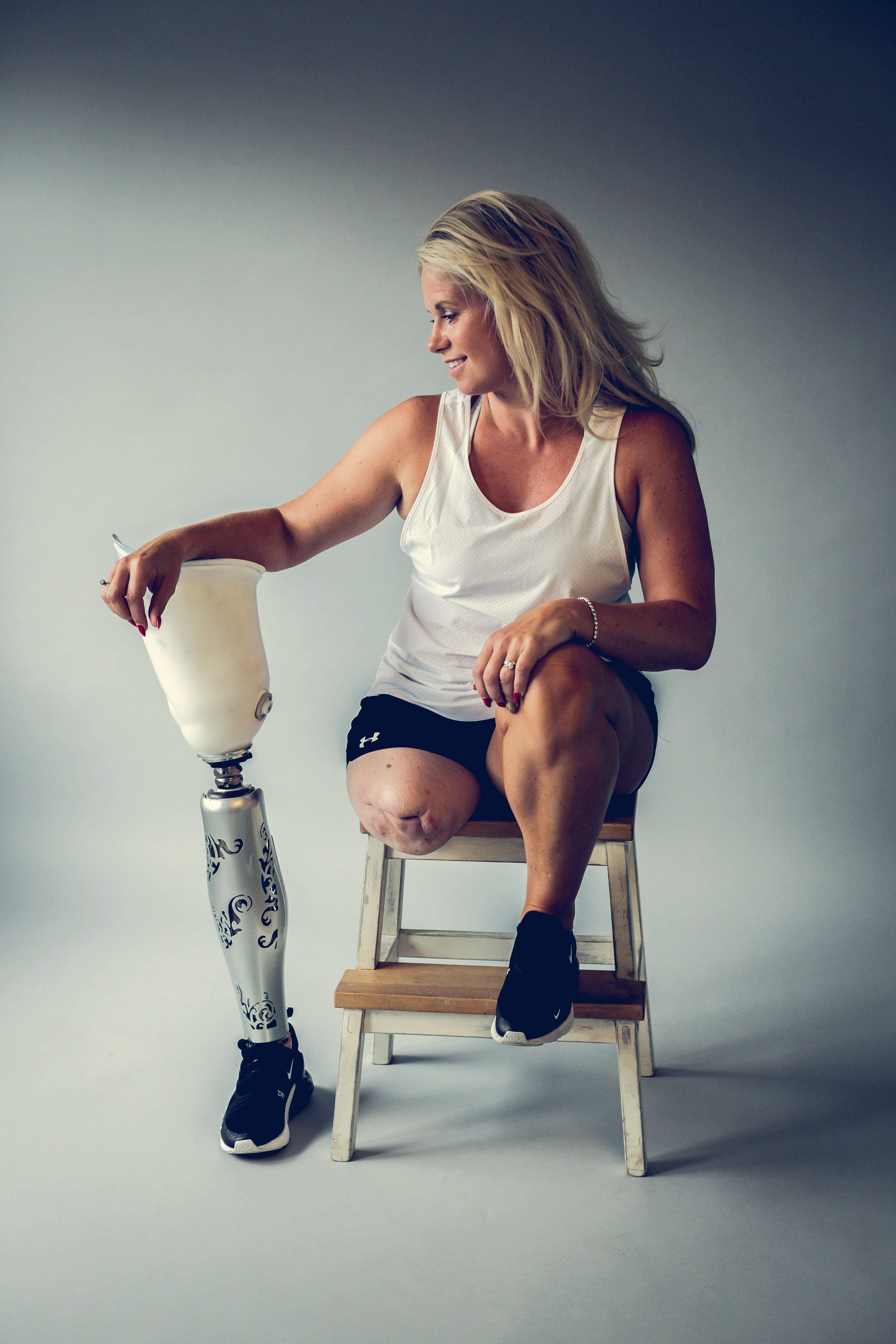 woman above knee prosthetic leg