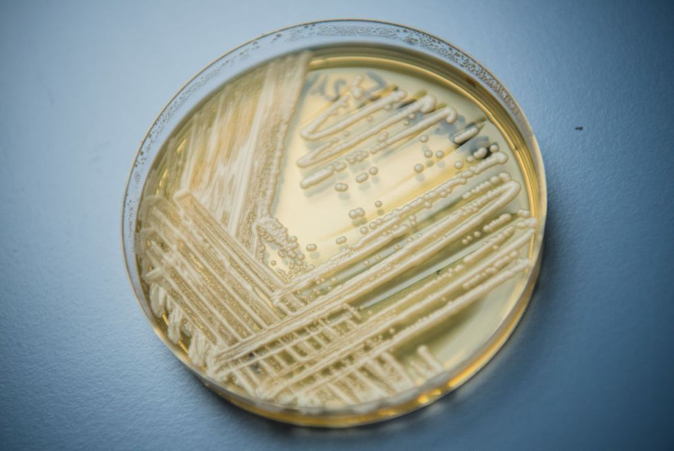 experts warn of newly discovered yeast