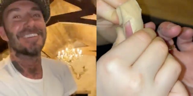 Skin, Nose, Hand, Mouth, Lip, Muscle, Finger, Jaw, 