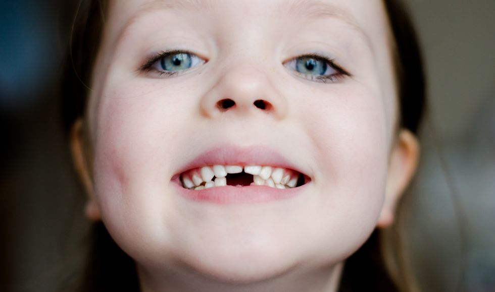 niña mostrando sus dientes de leche con un hueco en la mandíbula inferior
