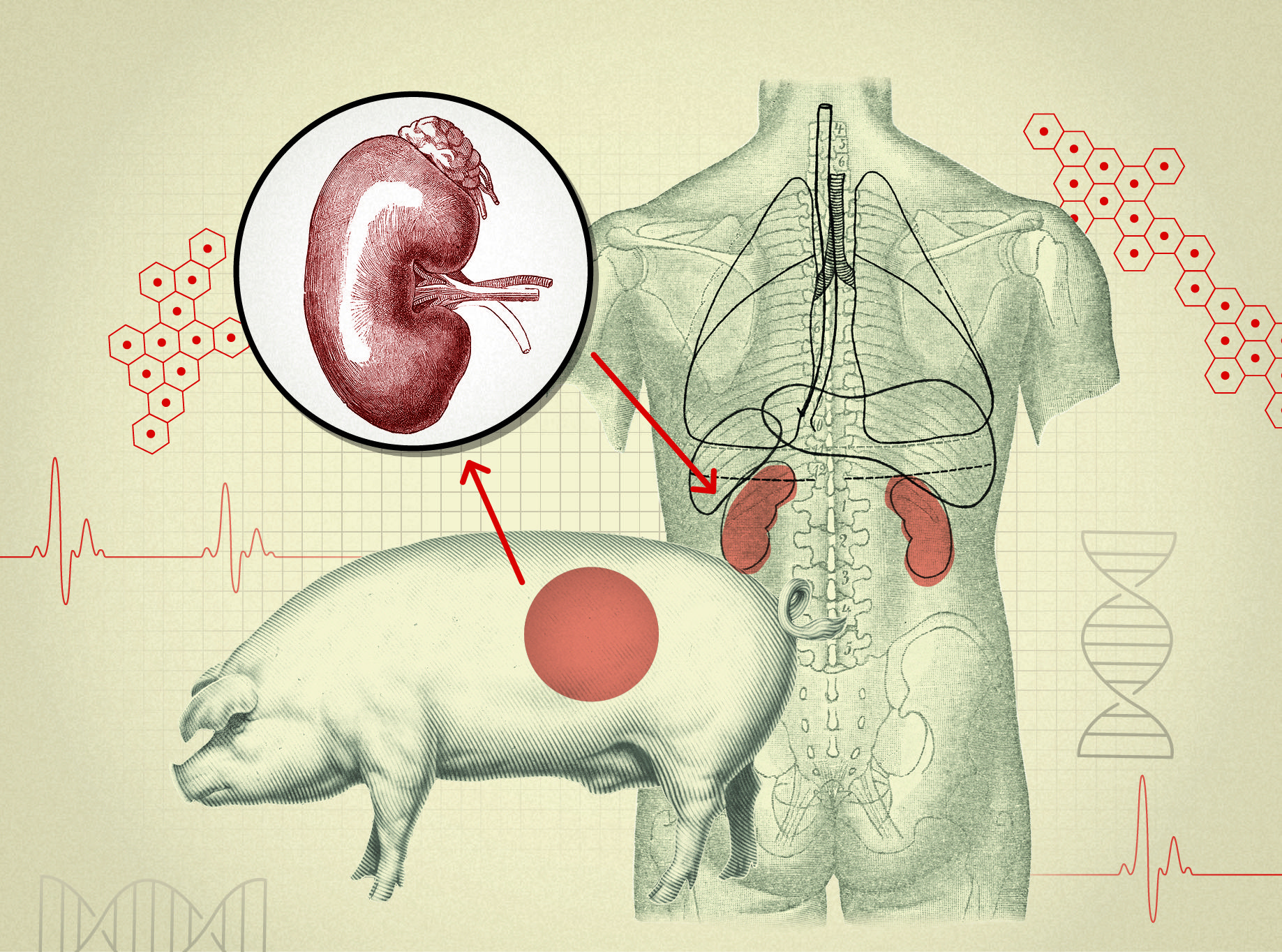 Pig to Human Organ Transplant | Can a Pig Heart Transplant to Humans?
