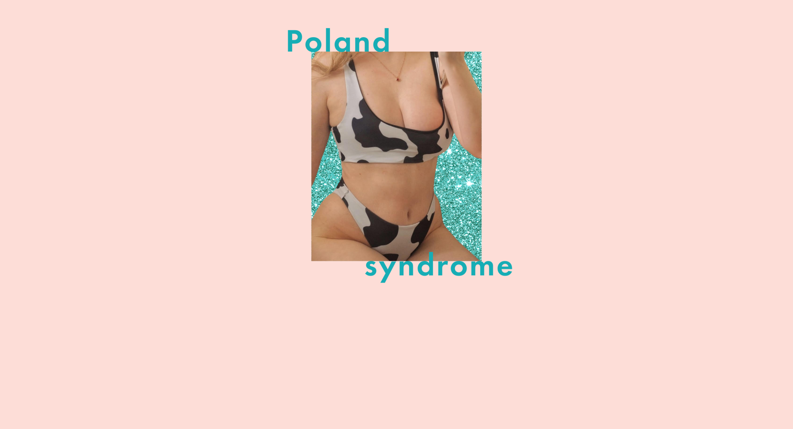 Poland Syndrome: What it's like to be a woman born with one boob