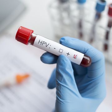 5人に4人が生涯で一度は感染すると言われている「hpv（ヒトパピローマウイルス）」。本記事ではhpvに関する、よくある誤解や定説について専門家が解説。「hpvに感染することはめったにない」「hpvに感染するのは、性的に活発な人だけ」「コンドームを使っていればhpvに感染しない」など、その真偽は？