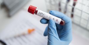 5人に4人が生涯で一度は感染すると言われている「hpv（ヒトパピローマウイルス）」。本記事ではhpvに関する、よくある誤解や定説について専門家が解説。「hpvに感染することはめったにない」「hpvに感染するのは、性的に活発な人だけ」「コンドームを使っていればhpvに感染しない」など、その真偽は？