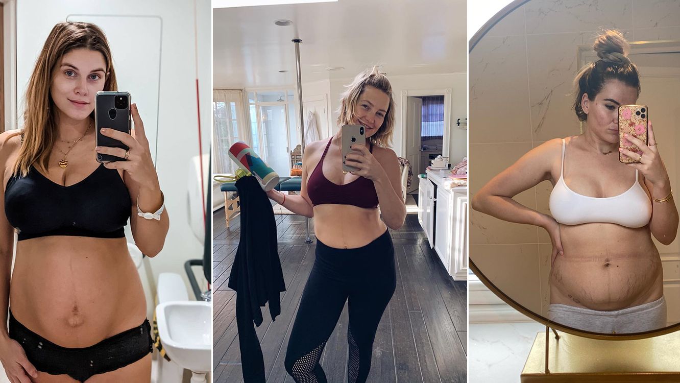 The secret to most celebrities post-baby bods is the #BellyBandit