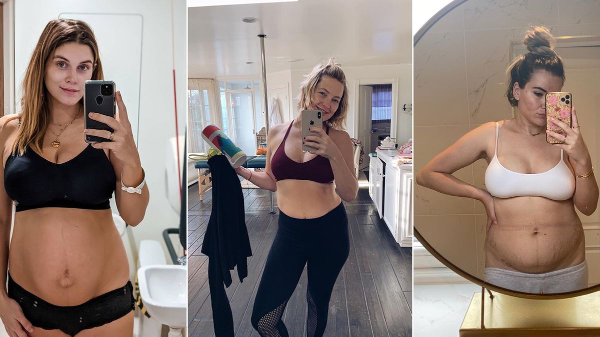 preview for 16 celebrities who got real about their post-baby bodies