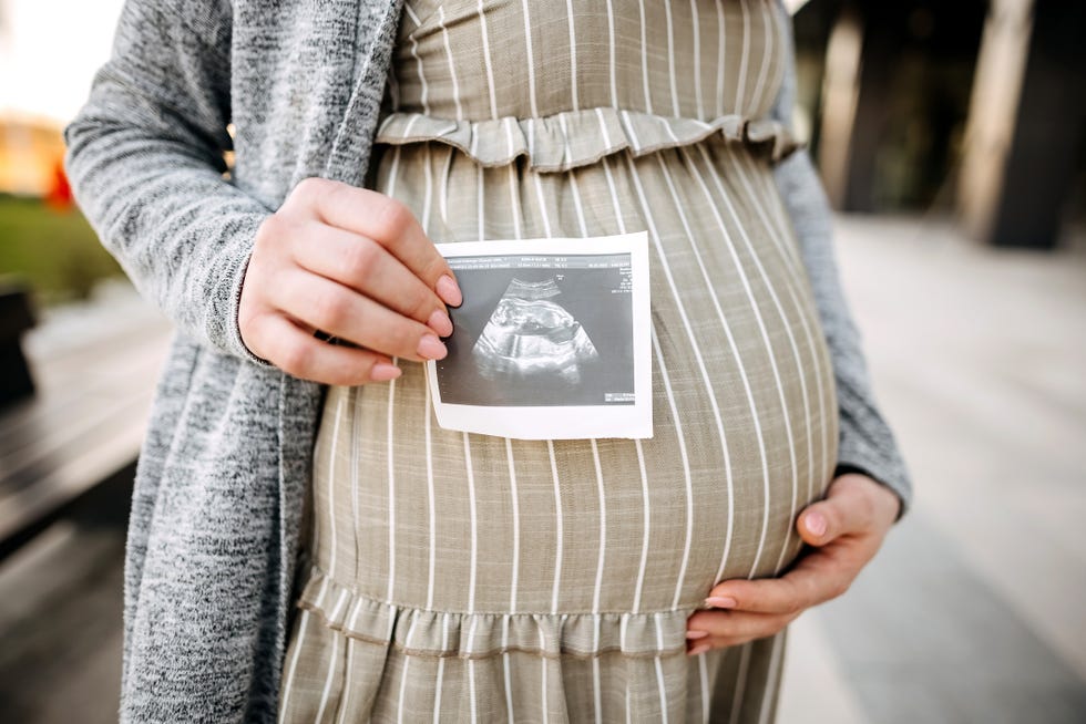 woman holding her baby bump while holding a sonogram photo in front of her