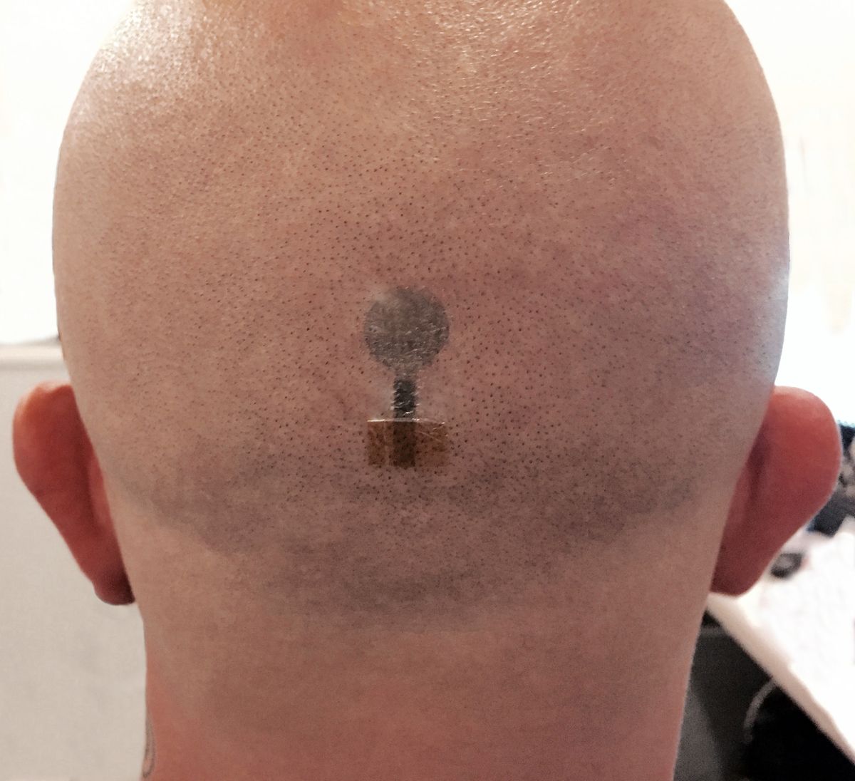 the back of a man's head with a tattoo electrode