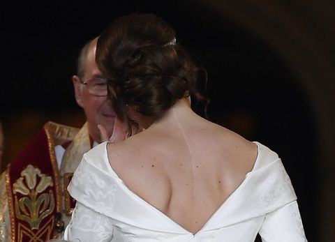 Hair, Shoulder, Hairstyle, Neck, Arm, Dress, Human body, Back, Bridal accessory, Chest, 