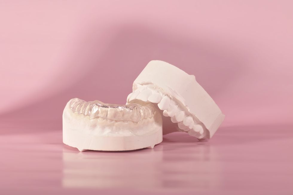 dentadura de adultos con el maxilar torcido
