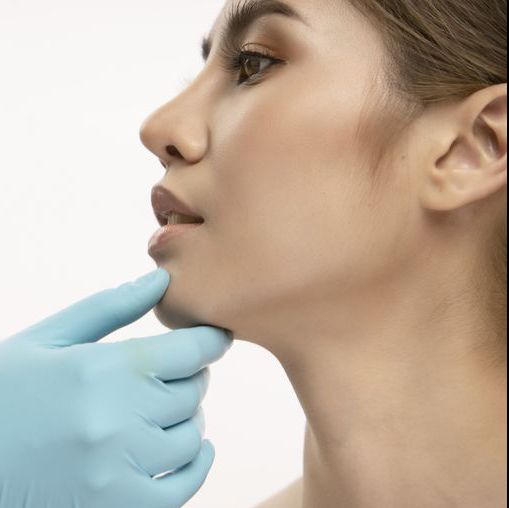 profile balancing with fillers explained