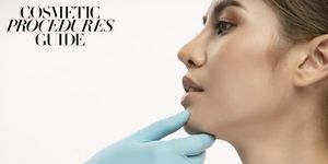 profile balancing with fillers explained