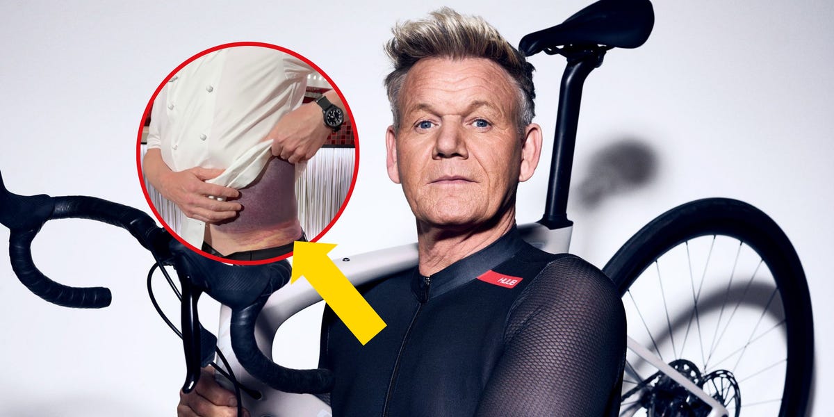 Gordon Ramsay reveals all about his “brutal” bicycle accident