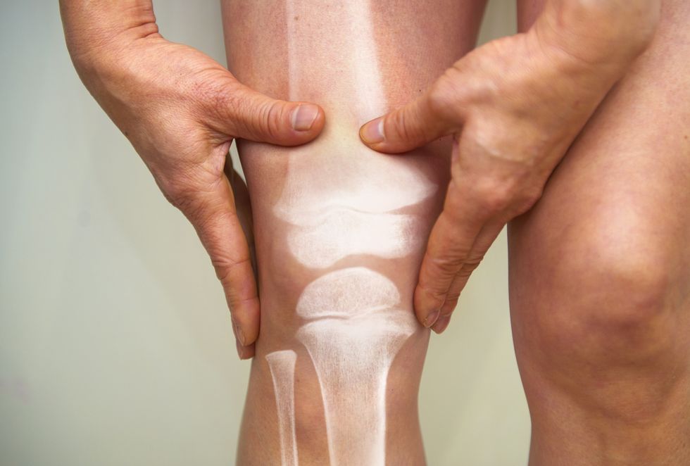 xray of knee  osteoarthritis and rheumatoid arthritis