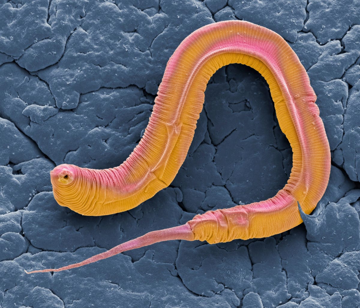 C elegans een worm die over de hele wereld in de aarde voorkomt is een van de meest bestudeerde dieren in biologisch en genetisch onderzoek