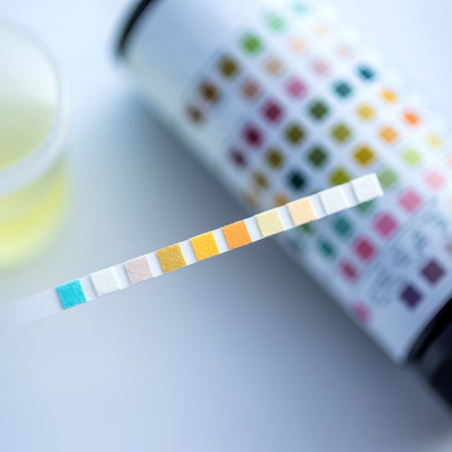 What Does the Color of My Pee Mean? 7 Urine Colors, Explained