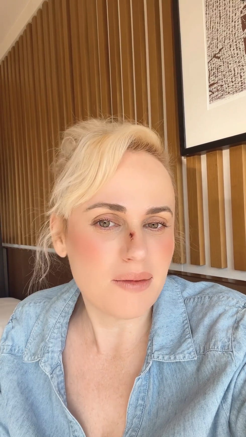 Kecelakaan Syuting Terpukul Senjata, Begini Kondisi Rebel Wilson