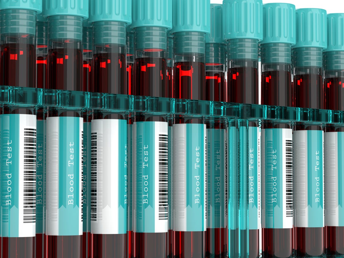 New Blood Doping Research Might End Doping in Sports