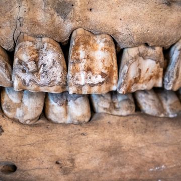 rhino teeth