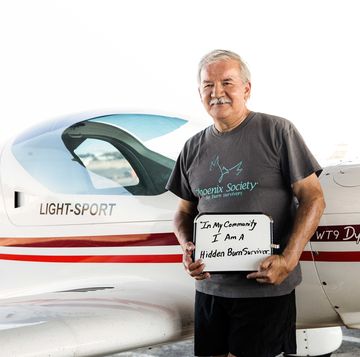 rich casias a burn survivor standing in front of a small white airplane