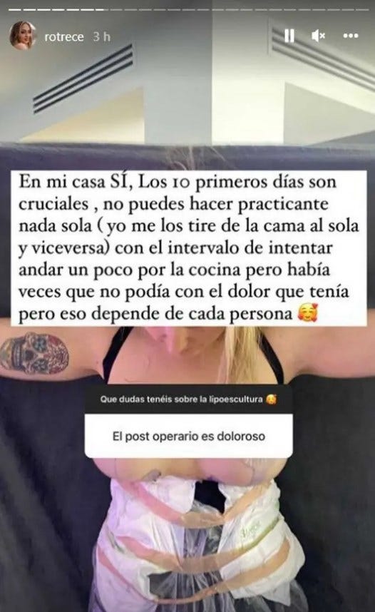 rocío flores muestra el resultado tras su operación de lipoescultura