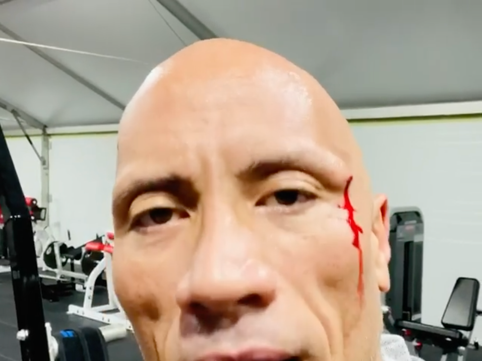 Dwayne 'The Rock' Johnson Hit Himself With a Chain Working Out