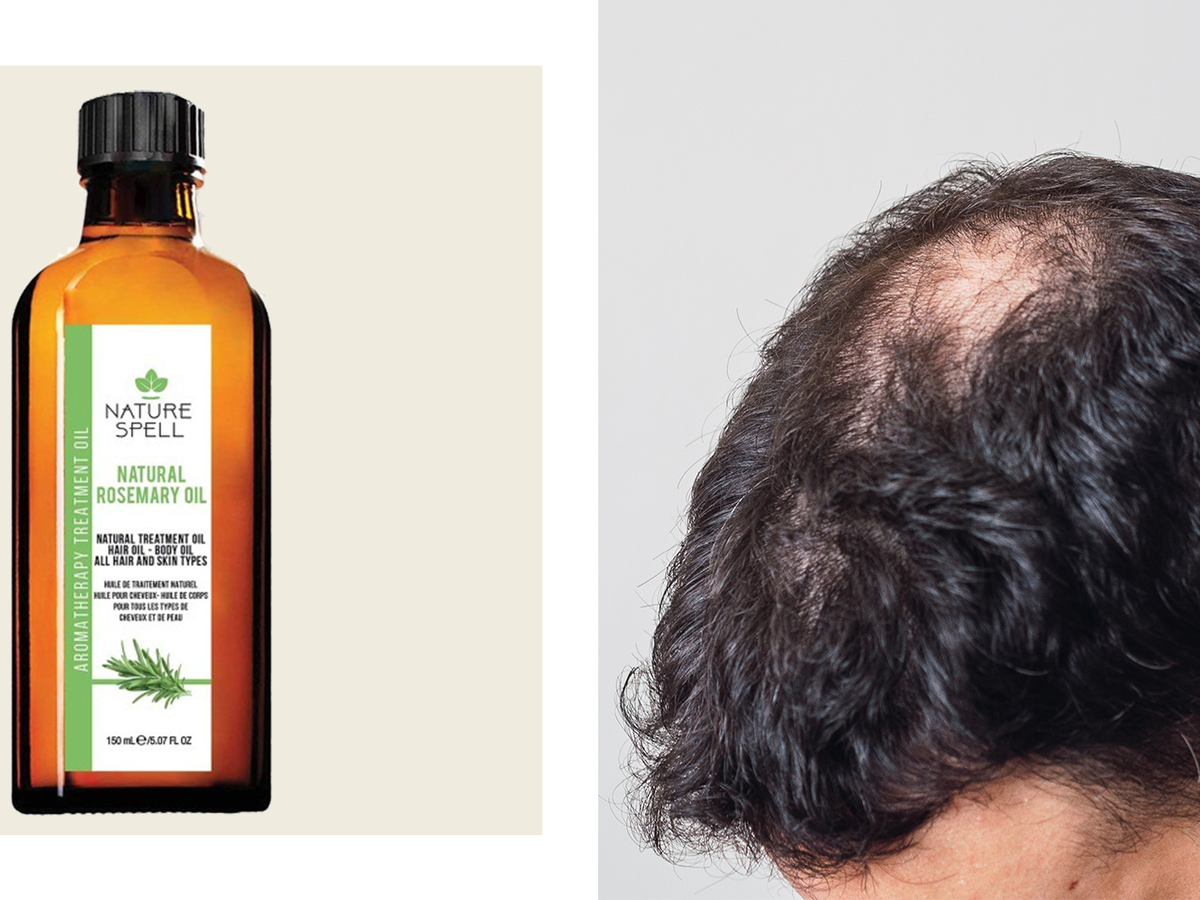 Rosemary Oil for Hair Growth? Dermatologists Aren't Convinced