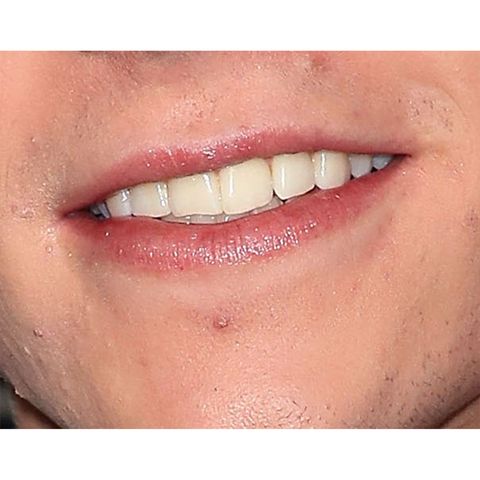 Lip, Tooth, Face, Skin, Jaw, Chin, Mouth, Cheek, Smile, Nose, 