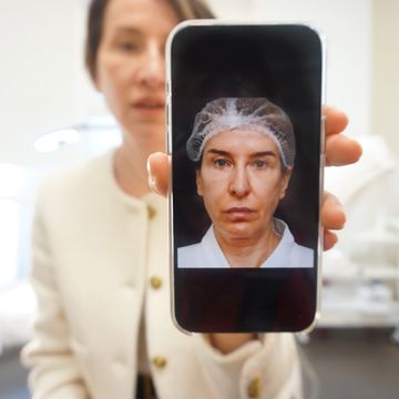 olga saienko shows a photo of her face before she got a facelift