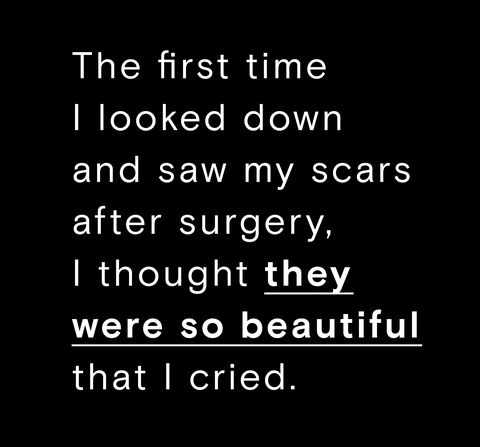 Scar Quotes - 5 Women Share What It's Like Living With Scars