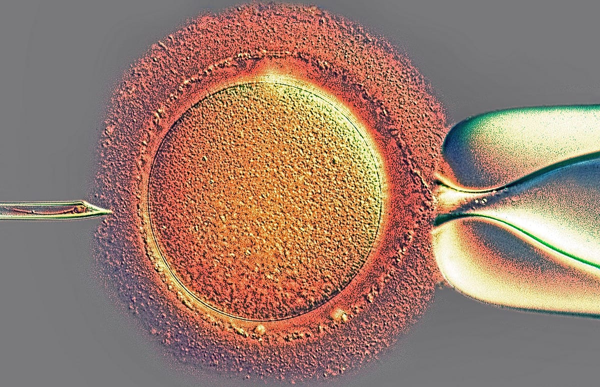 Bij invitrofertilisatie ivf wordt sperma in een eicel genjecteerd Hoewel de methode inmiddels veel wordt toegepast om onvruchtbaarheid te behandelen kan ze niet gebruikt worden bij mannen die geen sperma kunnen produceren als gevolg van kanker of andere ziekten in hun jeugd