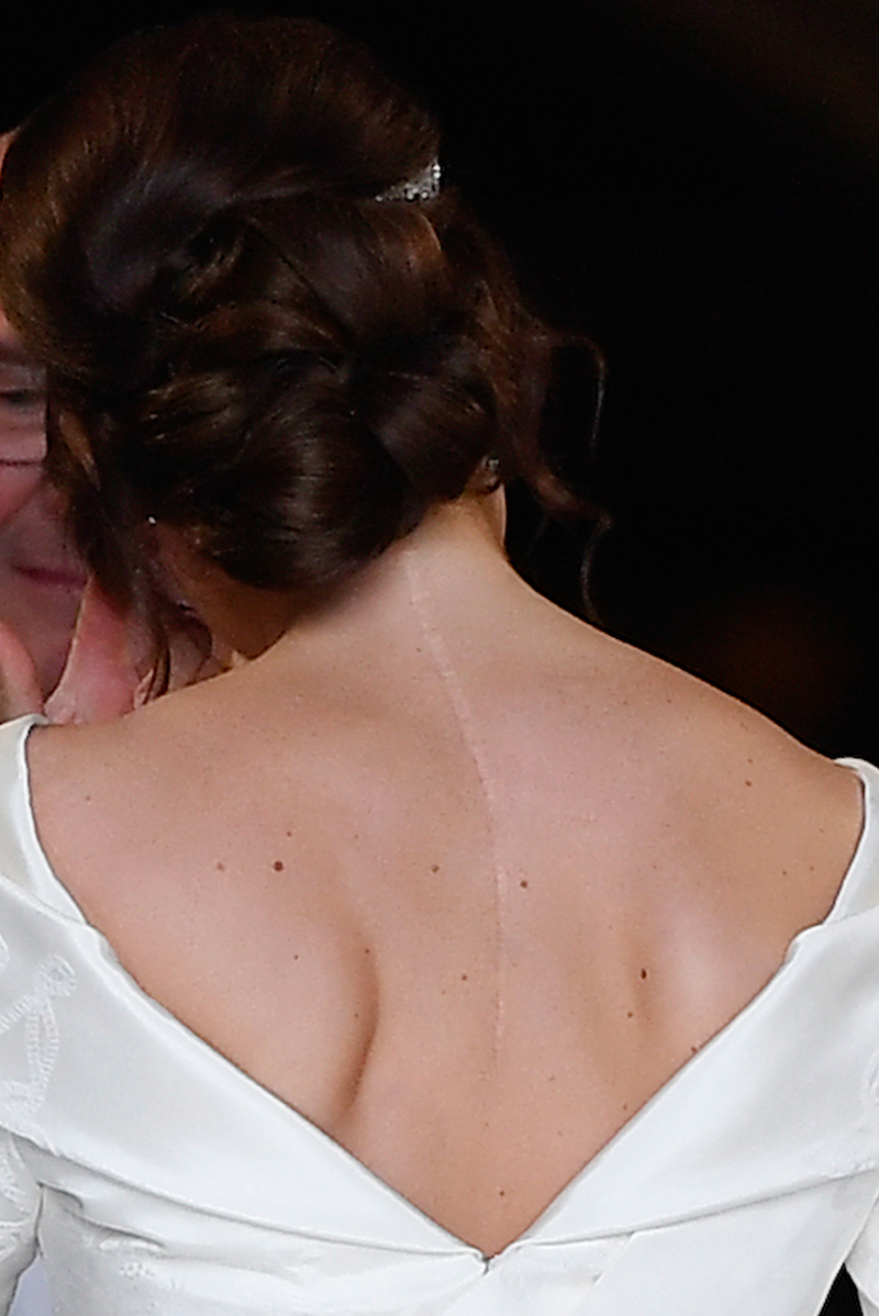 princess eugenie's scoliosis scar visible in her wedding dress