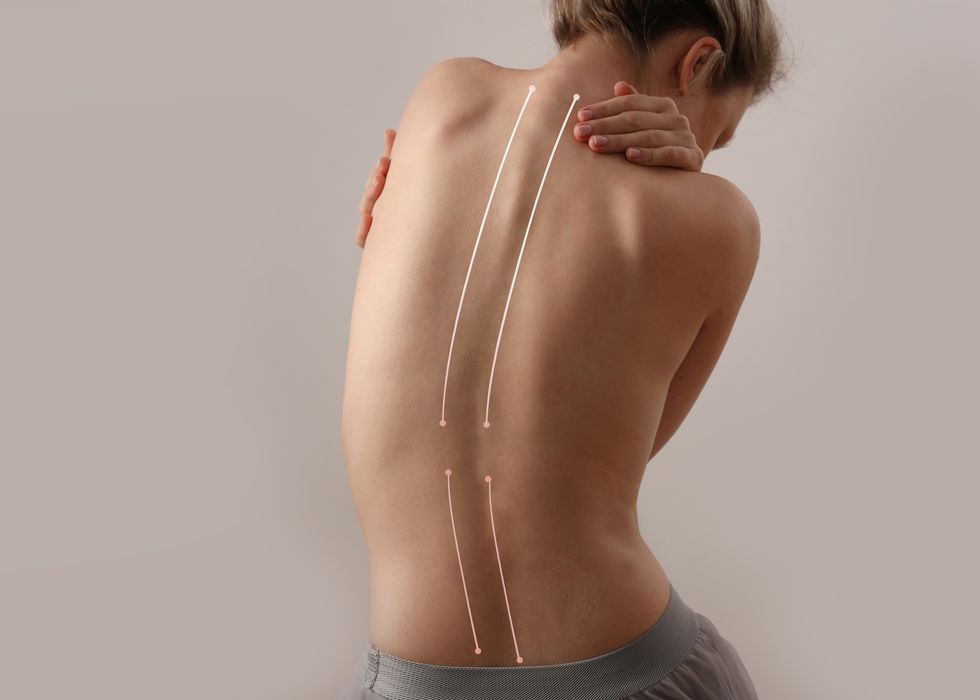 scoliosis spine curve anatomy, posture correction back pain relief accepting body limitations