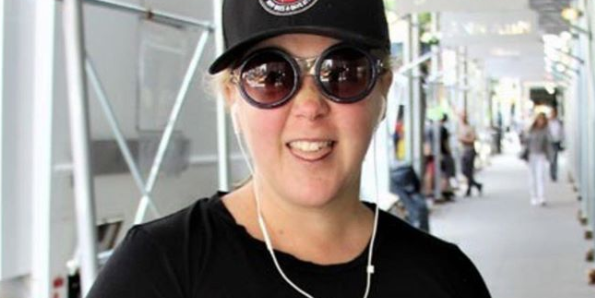 Amy Schumer Posts Unapologetic Postpartum Photo of Her C-Section Scar