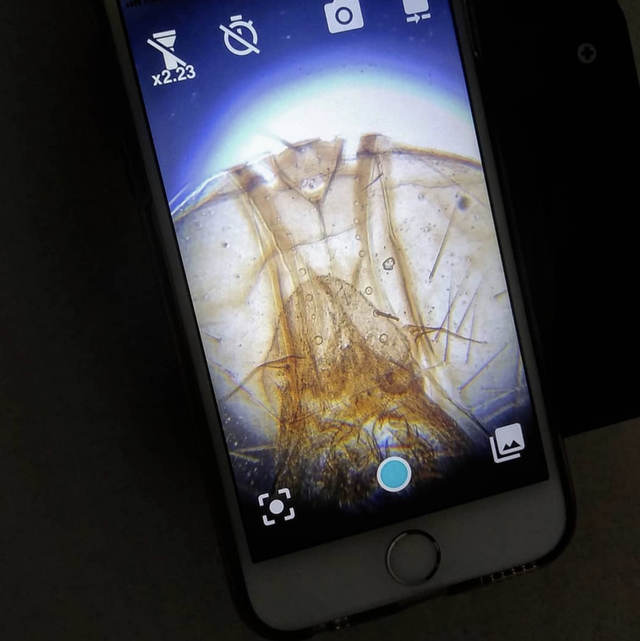 How to Use a Smartphone Microscope on an iPhone 