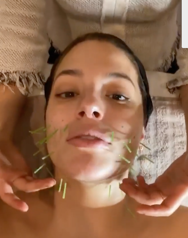 Ashley Graham Gets Facial Acupuncture in New Video