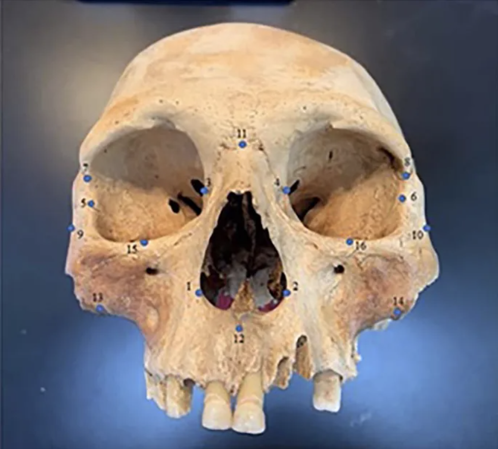 Skull, Bone, Skeleton, Jaw, Head, Human, Anthropology, Tooth, 