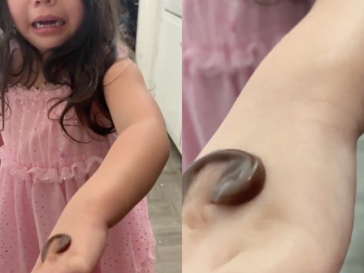 Syd glide Let Parents Are Tricking Their Kids With Food For The 'Poop Challenge'