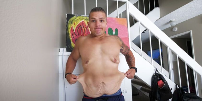 How This Man Managed Loose Skin After Weight Loss